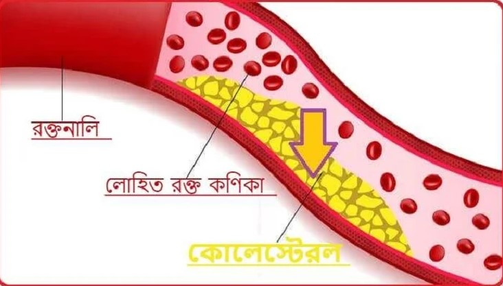 কোলেস্টেরল নিয়ন্ত্রণ করবেন কীভাবে?