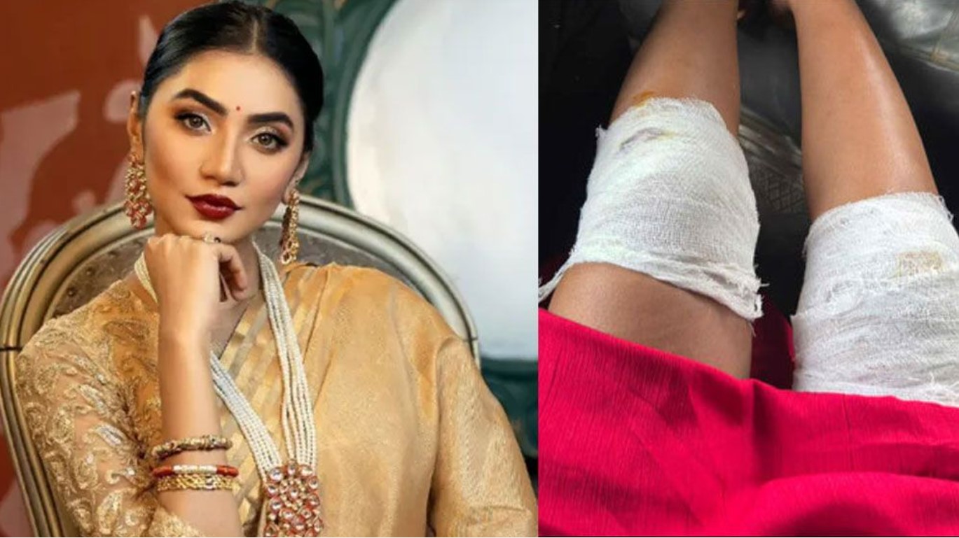 নাটকের শুটিং সেটে দুর্ঘটনার শিকার অভিনেত্রী সুনেরাহ বিনতে কামাল