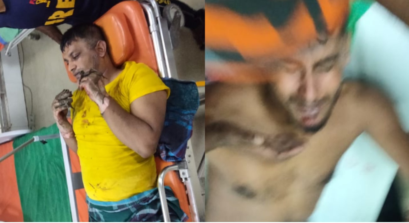 টঙ্গীর কেমিক্যাল গোডাউনের আগুন নিয়ন্ত্রণে, আহত ৫ 