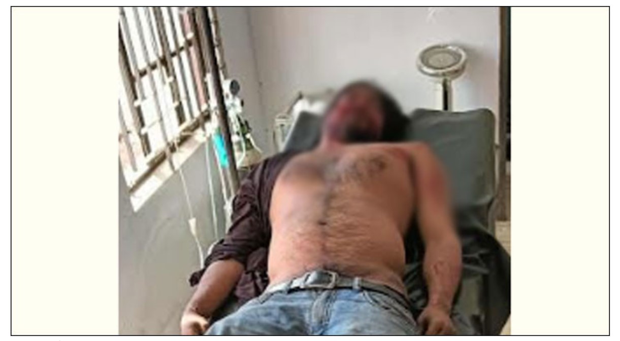 বান্দরবানে মোটরসাইকেল খাদে, পর্যটকের মৃত্যু