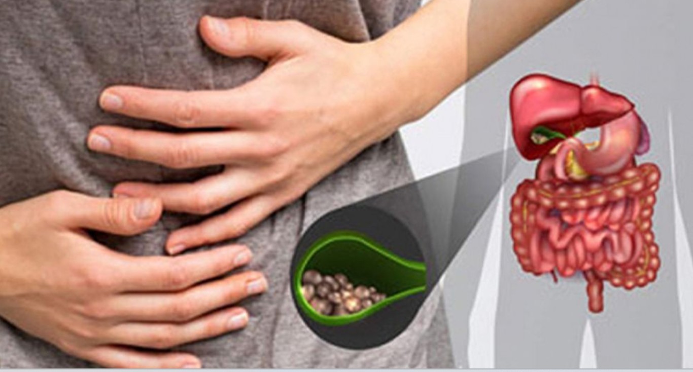 পিত্তথলিতে পাথর হওয়ার অন্যতম ৫টি কারণ যেগুলো